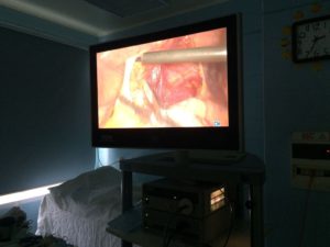 визуализация мочеточника во время операции