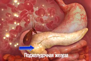 Громыко -Опухоли поджелудочной железы