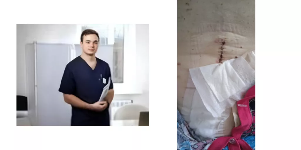 Снятие металлических скоб на дому в Ростове-на-Дону после операции 