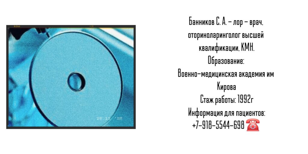 Банников Сергей Анатольевич - лор хирург в Ростове-на-Дону
