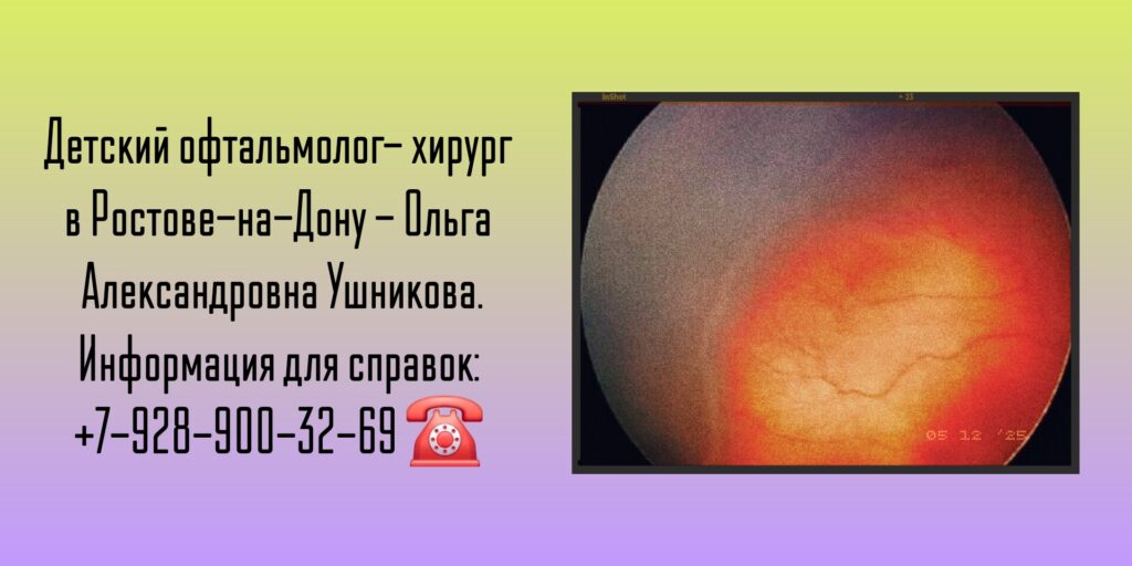 Детский офтальмолог в Ростове-на-Дону- Ушникова Ольга Александровна