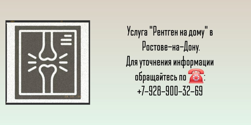 Вызов на дом врача - Рентген на дому Ростов-на-Дону