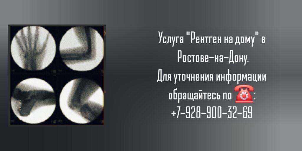 Вызов на дом врача - Рентген на дому Ростов-на-Дону