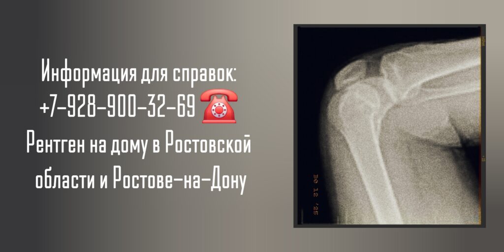 Рентген на дому Ростов-на-Дону