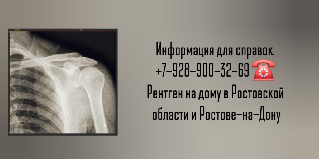 Рентген на дому Ростов-на-Дону