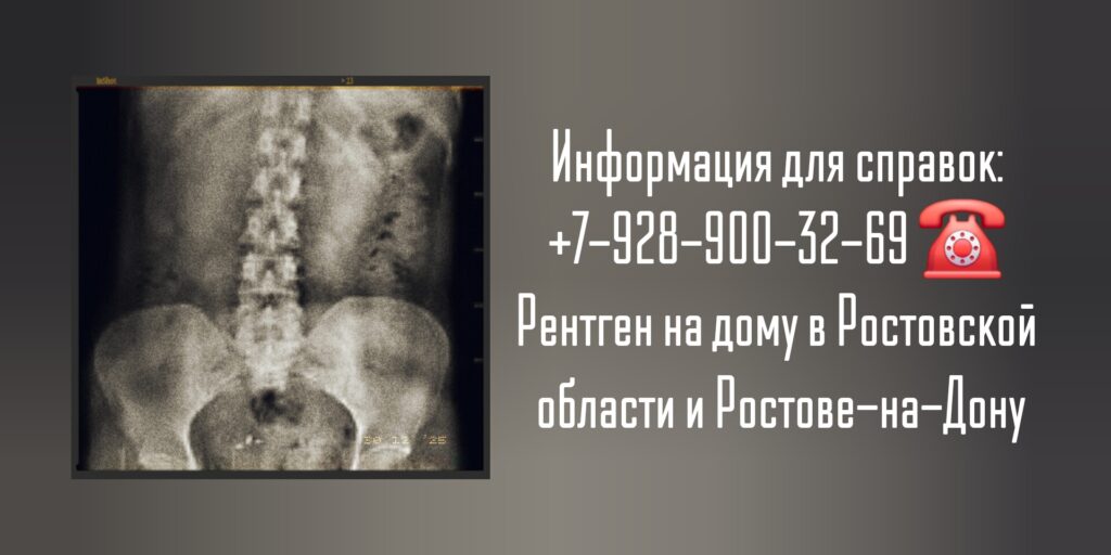 Рентген на дому Ростов-на-Дону