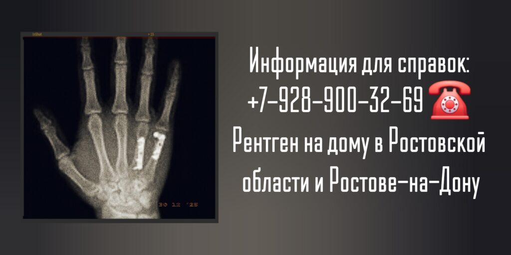Рентген на дому Ростов-на-Дону