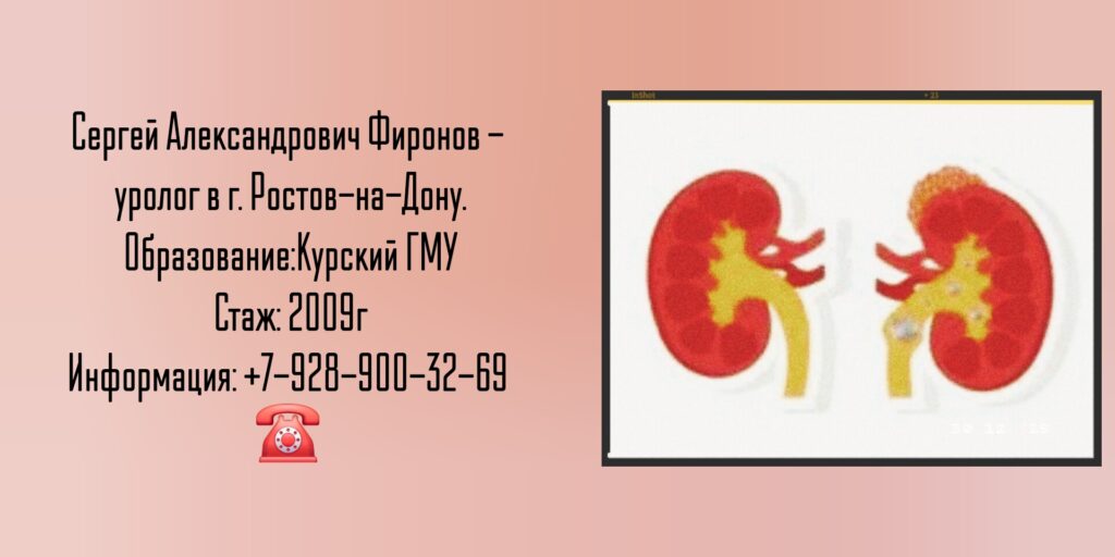 Уролог Ростов - Фиронов Сергей Александрович 