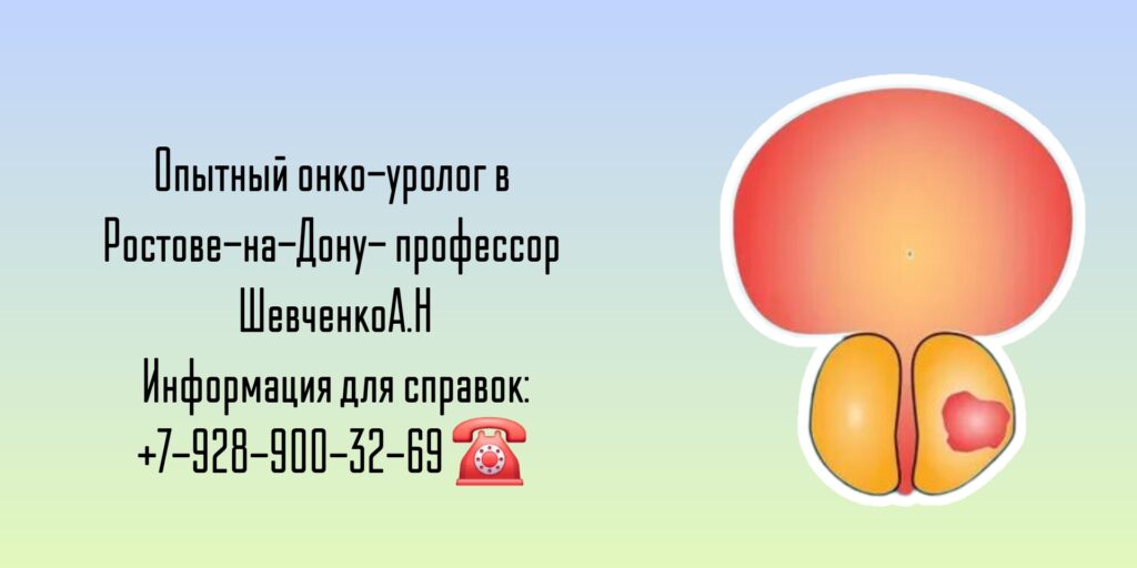 Консультация онколог-уролог в Ростове-на-Дону - Шевченко А. Н.