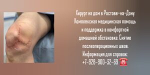 Швы после операции- снять на дому в Ростове-на-Дону 