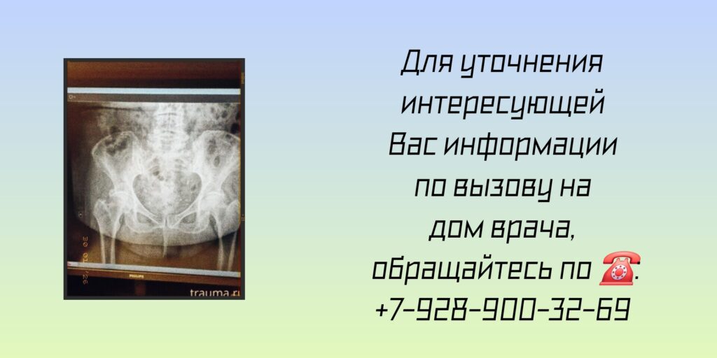 Вызов врача на дом - Ростов-на-Дону - Рентген на дому 