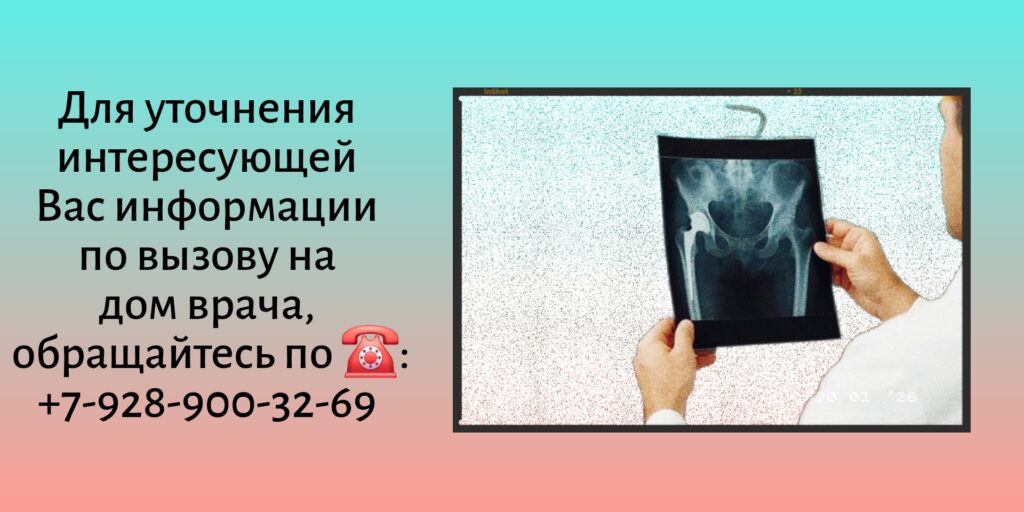 Вызов врача на дом - Ростов-на-Дону - Рентген на дому 