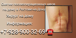 Снятие швов на дому в Ростове-на-Дону: удобно комфортно и профессионально