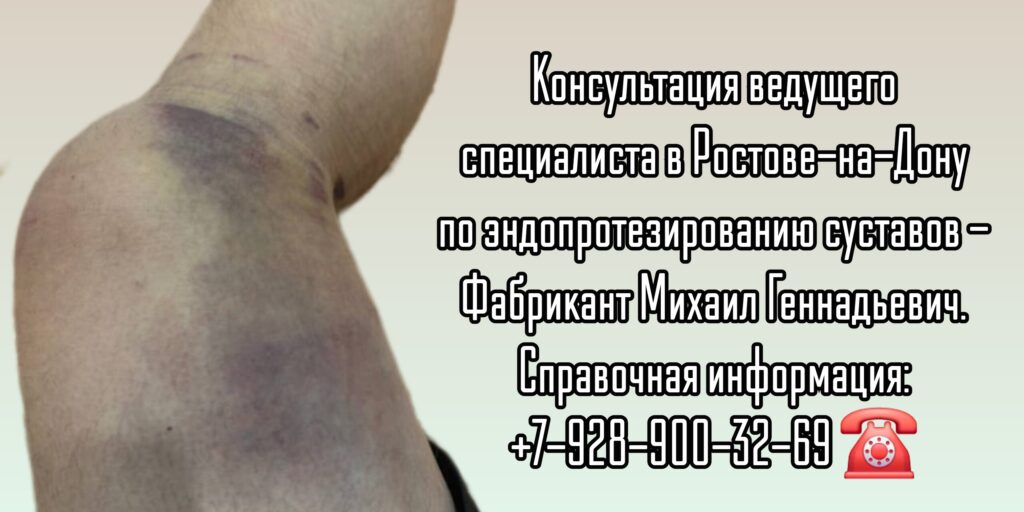 Врач ортопед - травматолог Ростов-на-Дону - Фабрикант Михаил Геннадьевич 
