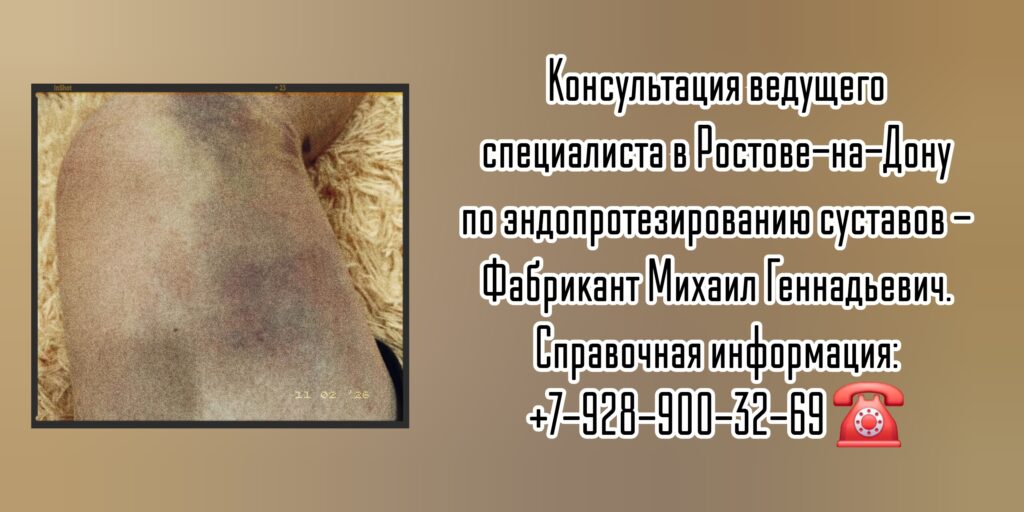 Врач ортопед - травматолог Ростов-на-Дону - Фабрикант Михаил Геннадьевич 