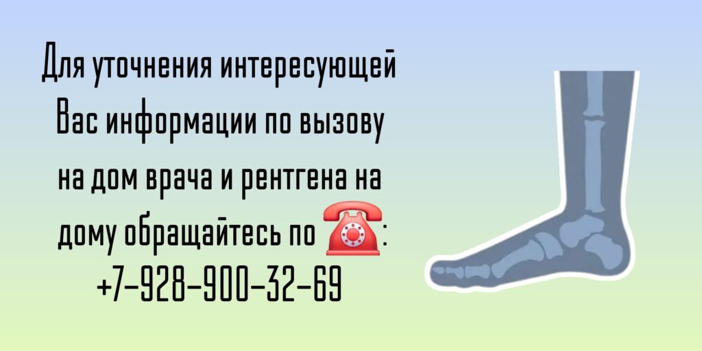 Вызов врача на дом - Ростов-на-Дону - Рентген на дому 