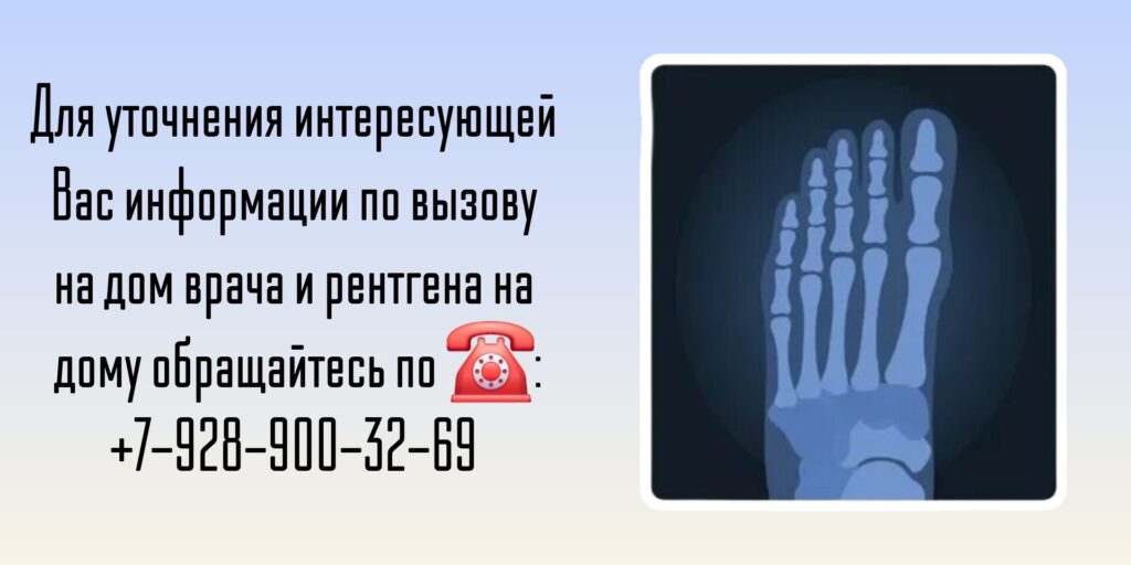 Вызов врача на дом - Ростов-на-Дону - Рентген на дому 