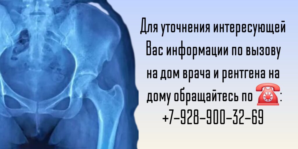 Вызов врача на дом - Ростов-на-Дону - Рентген на дому 