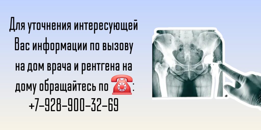 Вызов врача на дом - Ростов-на-Дону - Рентген на дому 