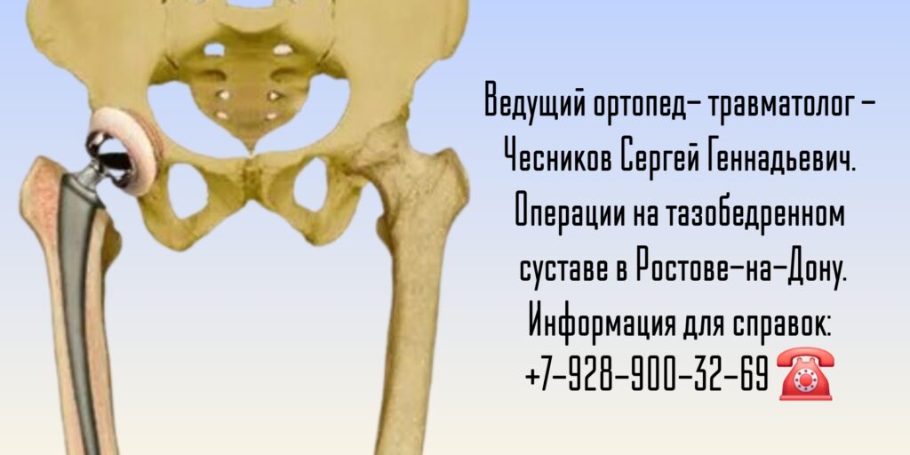 Чесников Сергей Геннадьевич - Тазобедренный сустав - травмы и заболевания Ростов-на-Дону 