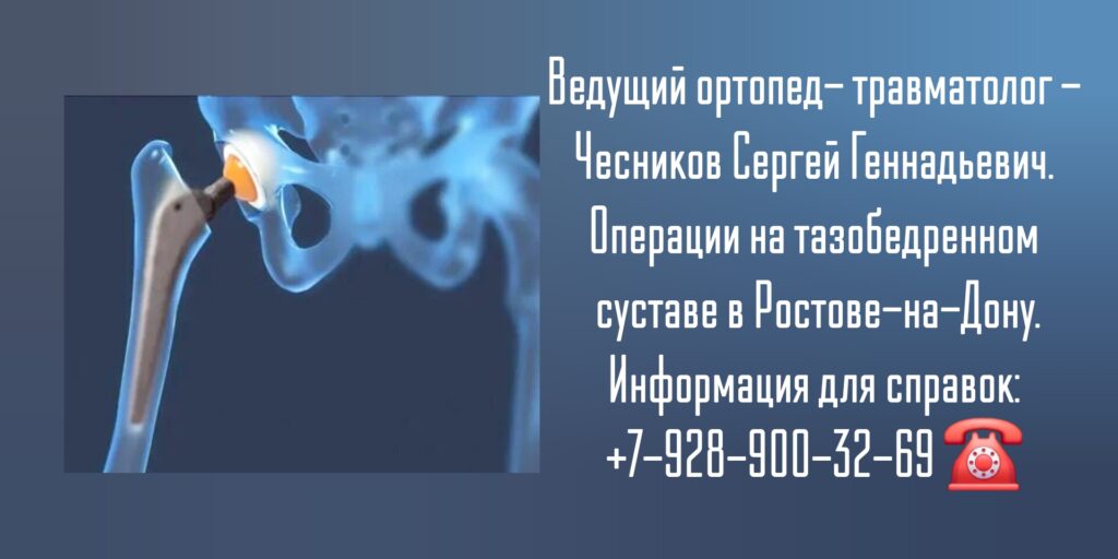 Чесников Сергей Геннадьевич - Тазобедренный сустав - травмы и заболевания Ростов-на-Дону 