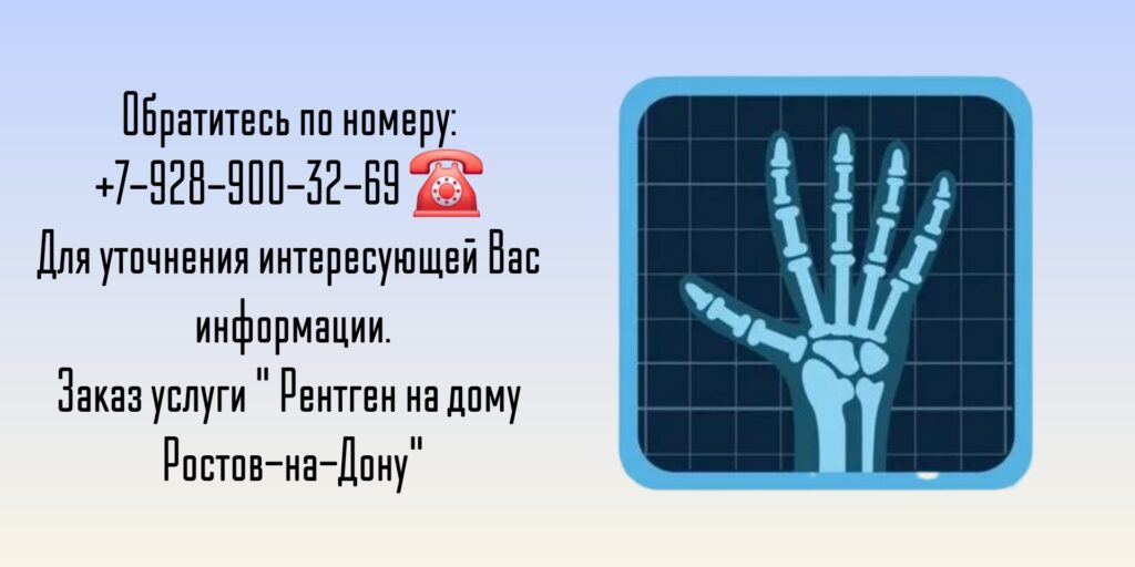 Вызов врача в Ростове-на-Дону- рентген на дому