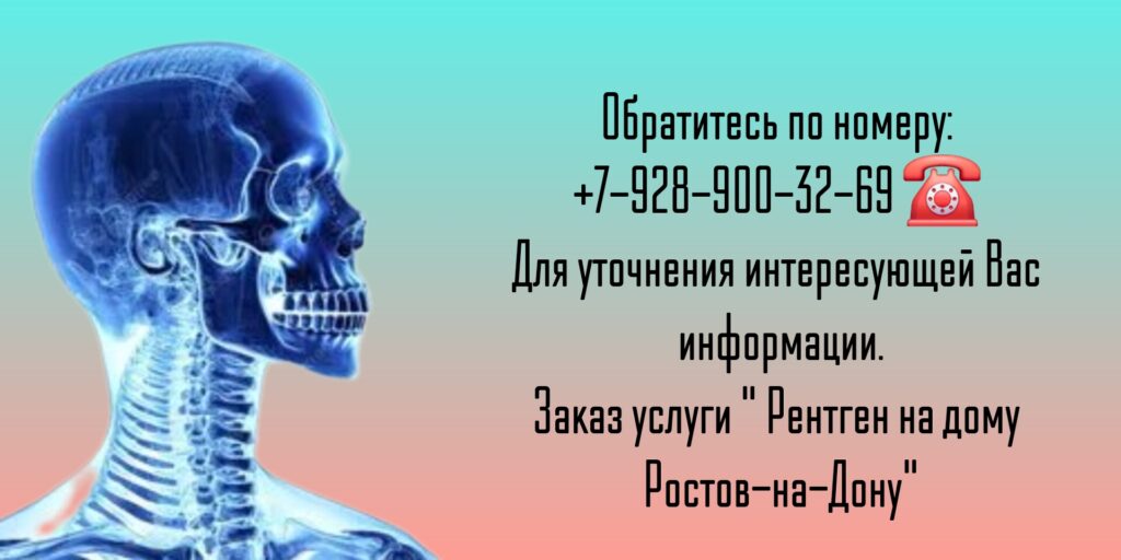 Вызов врача в Ростове-на-Дону- рентген на дому