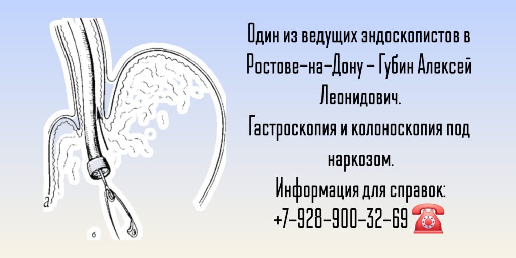 Ростов - колоноскопия под наркозом- ведущие эндоскописты
