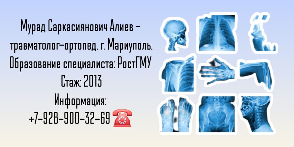 Алиев Мурад Саркасиянович - ортопед-травматолог Мариуполь
