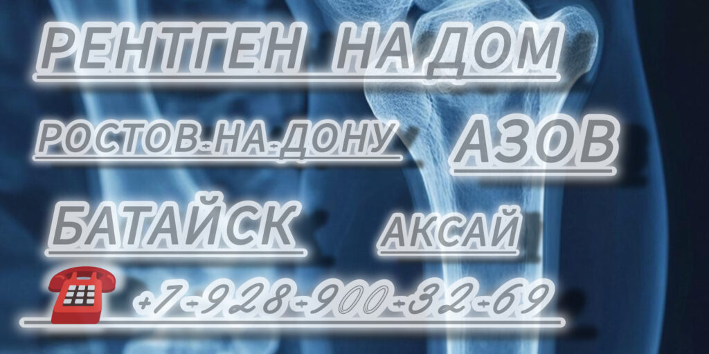 Ростов диагностика Рентген на дому 