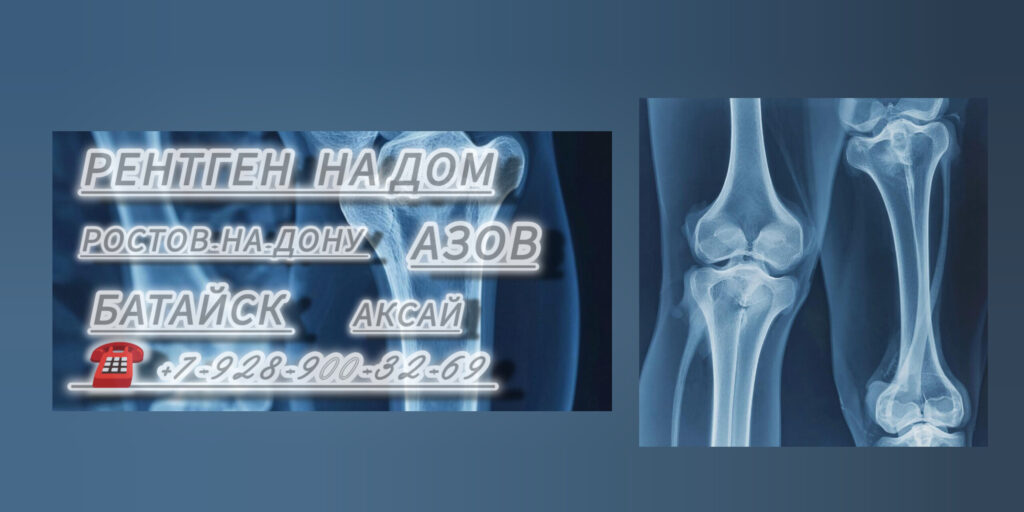 Ростов диагностика Рентген на дому 
