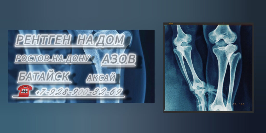 Ростов диагностика Рентген на дому 