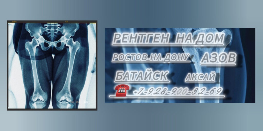 Ростов диагностика Рентген на дому 