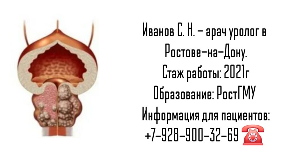 Иванов Сергей Никитич - уролог Ростов