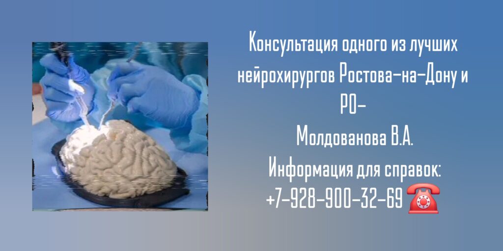 Ведущий нейрохирург в Ростове-на-Дону- Молдованов Владимир Архипович
