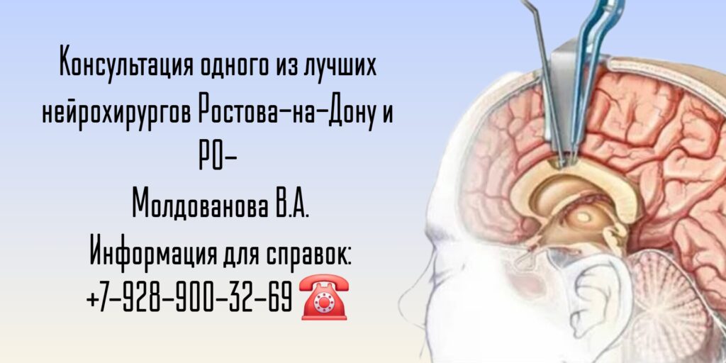 Ведущий нейрохирург в Ростове-на-Дону- Молдованов Владимир Архипович