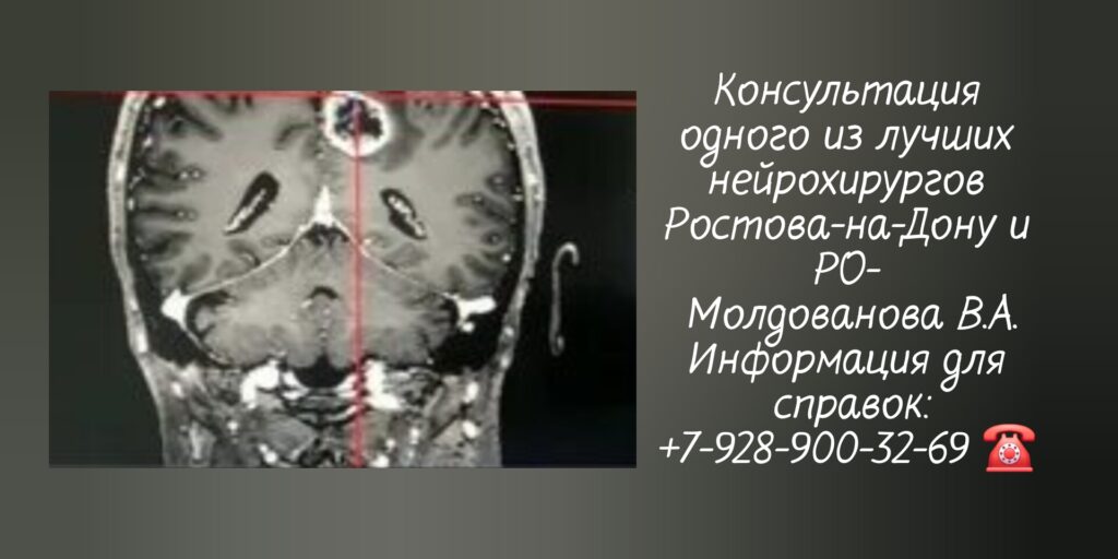 Ведущий нейрохирург в Ростове-на-Дону- Молдованов Владимир Архипович