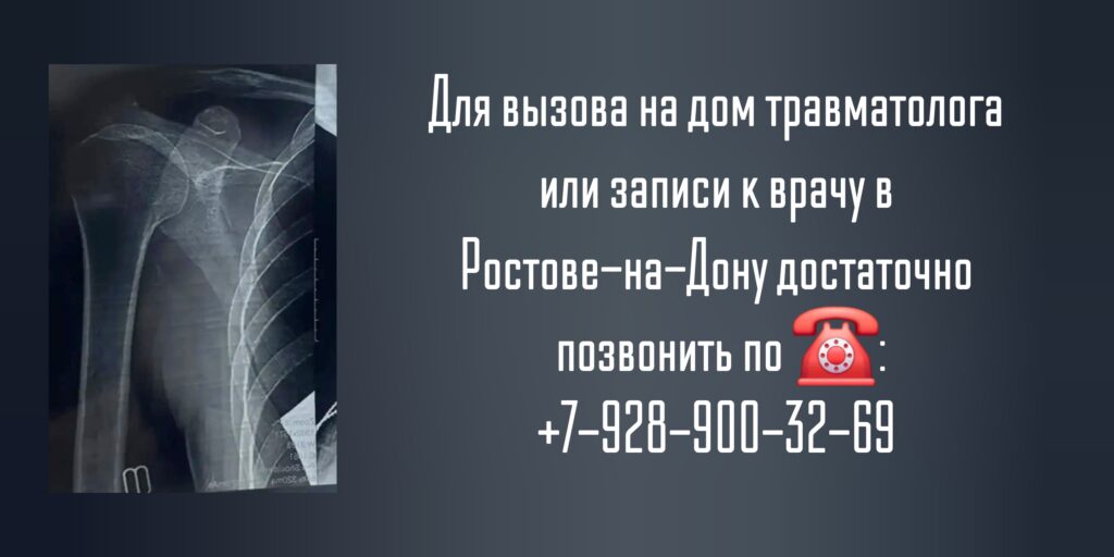 Консультация травматолога в Ростове-на-Дону