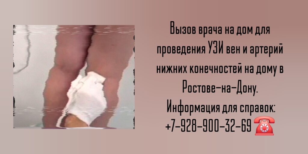 Вызов на дом врача в Ростове-на-Дону - УЗИ вен и артерий нижних конечностей