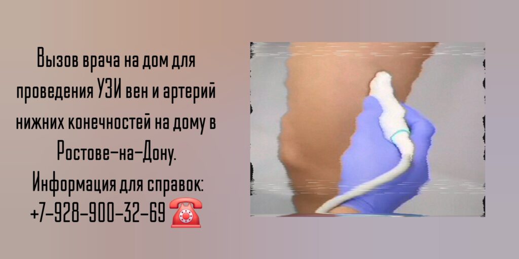 Вызов на дом врача в Ростове-на-Дону - УЗИ вен и артерий нижних конечностей