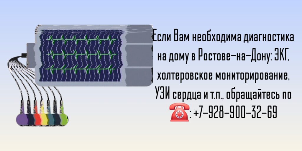 Ростов ЭКГ на дому - вызов врача
