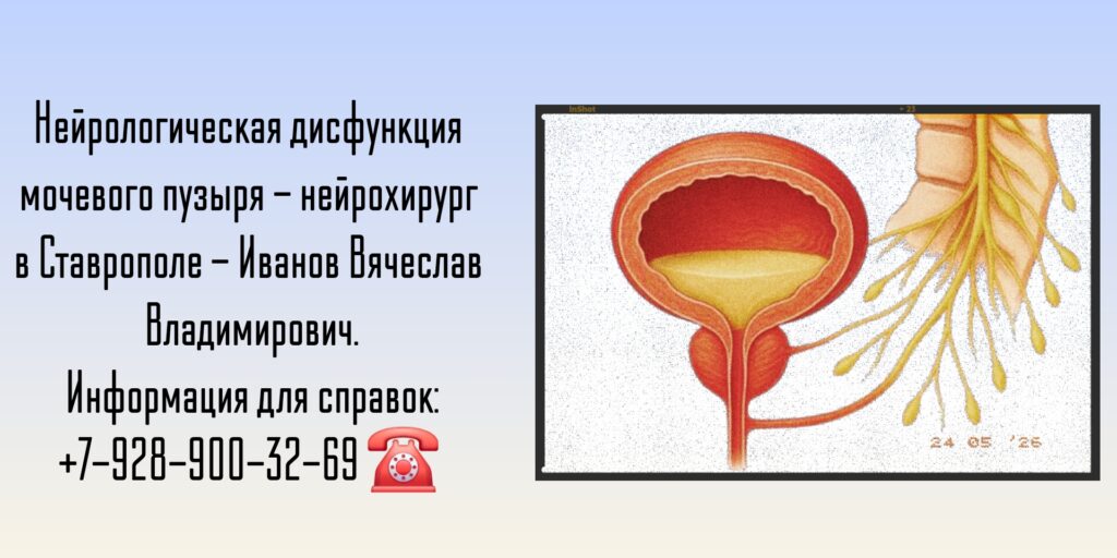 Нейрологическая дисфункция мочевого пузыря - нейрохирург в Ставрополе 