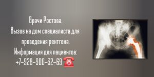 Вызов врача Ростов Рентген на дому 
