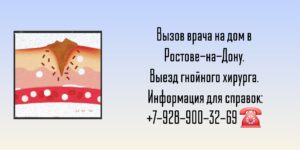 Гнойный хирург в Ростове-на-Дону- Вызов на дом