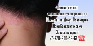 Консультация дерматолога - венеролога в Ростове-на-Дону- Пономарев Юрий Константинович