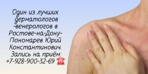 Консультация дерматолога - венеролога в Ростове-на-Дону- Пономарев Юрий Константинович