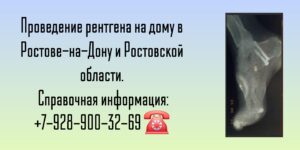 Врач на дом в Ростове-на-Дону- Рентген на дому 