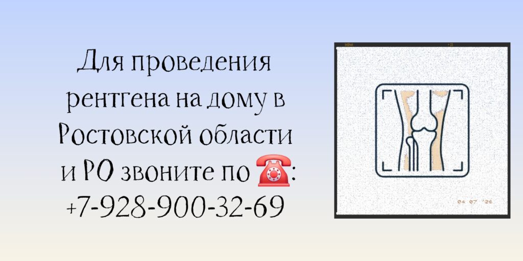 Доктор на дом в Ростове-на-Дону - Рентген на дому