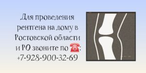 Доктор на дом в Ростове-на-Дону - Рентген на дому 