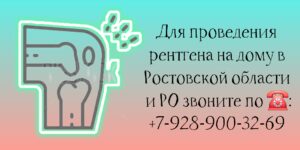 Доктор на дом в Ростове-на-Дону - Рентген на дому 